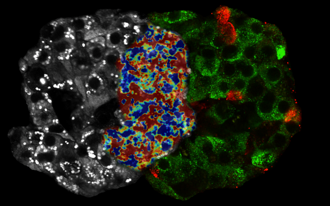 Infrared light to measure metabolic signals in the human pancreas.